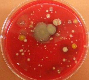 Bacterial growth on blood agar plate