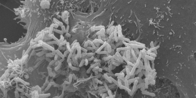 Zur Seite: Virulence factors of toxigenic corynebacteria
